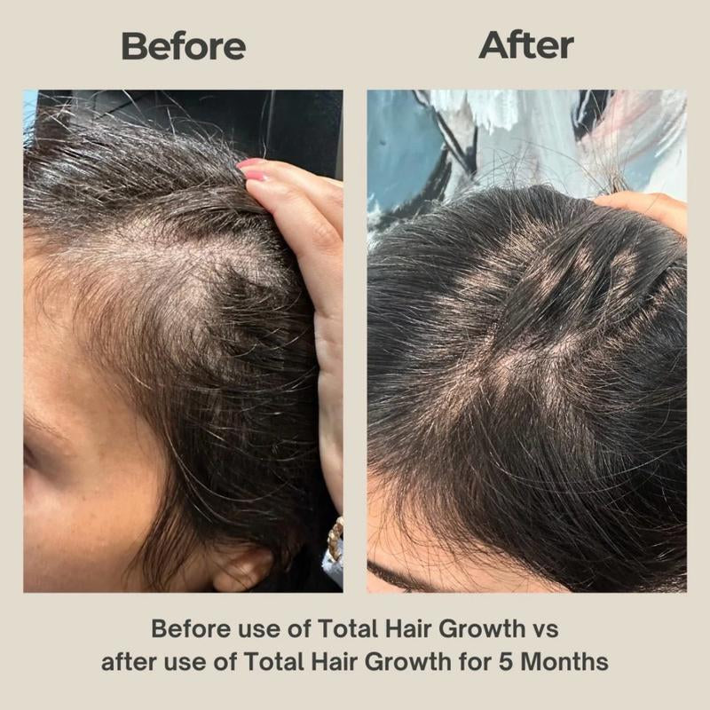 Total Hair Growth - Holistic Root Cause Hair Loss Supplement