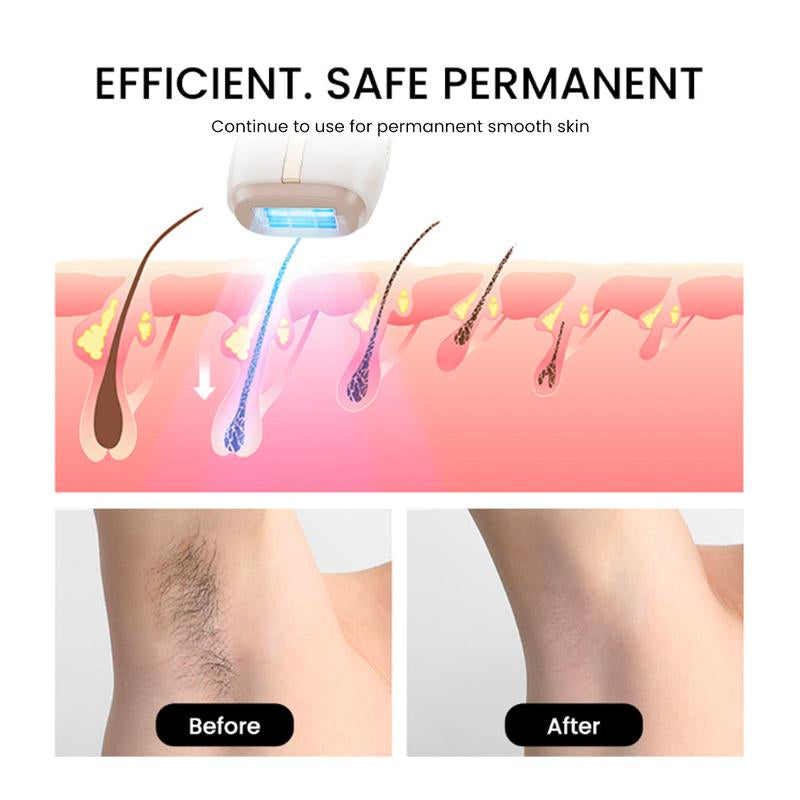 AMIRO Icesmooth At-Home Laser IPL Hair Removal Device, Safe and Painless, Gift for Women & Men